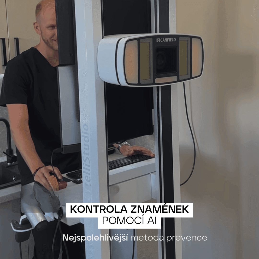 MUDr. Martin Bortlík, dermatolog ze Skinity Clinic, stojí u přístroje IntelliStudio by Canfield, který provádí kontrolu znamének pomocí umělé inteligence. Text na obrázku říká: ‚Kontrola znamének pomocí AI – Nejspolehlivější metoda prevence.‘