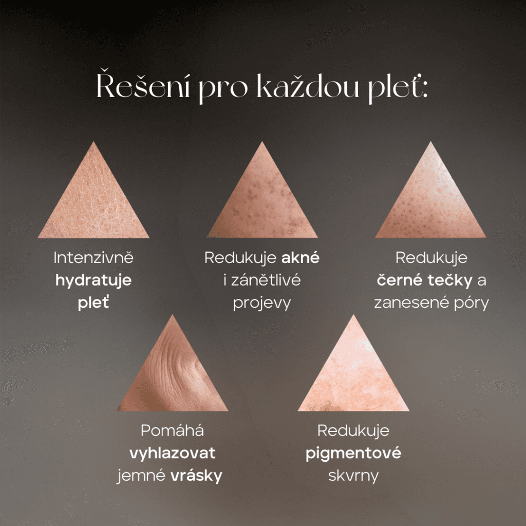 Graphic with the text “A solution for every skin type,” showing the effects of HydraFacial treatment: intense hydration and reduction of acne, blackheads, wrinkles, and pigmentation spots.