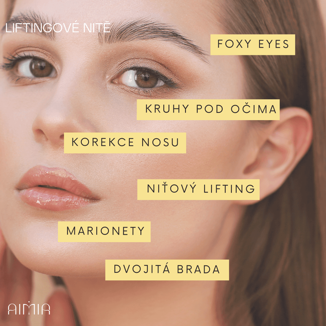 Close-up portrait of a woman with smooth skin used in a campaign for thread lifting. The image highlights treatment areas: foxy eyes, under‑eye circles, nose correction, thread lift, marionette lines, and double chin.